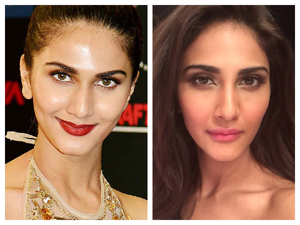Vaani Kapoor Undergoes Lip Surgery To Boost Career? Vaani Kapoor Undergoes Lip Surgery To Boost Career?
