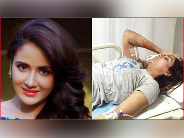 Parul Yadav savaged by stray dogs Parul Yadav savaged by stray dogs