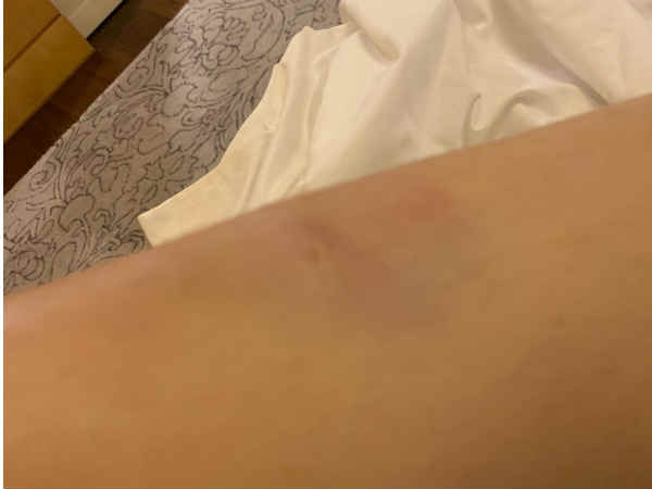 Actress Hansika gets injured in Maha’s Daring stunt sequence Actress Hansika gets injured in Maha’s Daring stunt sequence