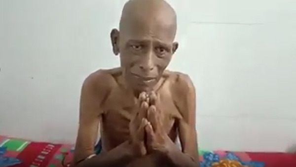 புற்றுநோய்க்கு சிகிச்சை