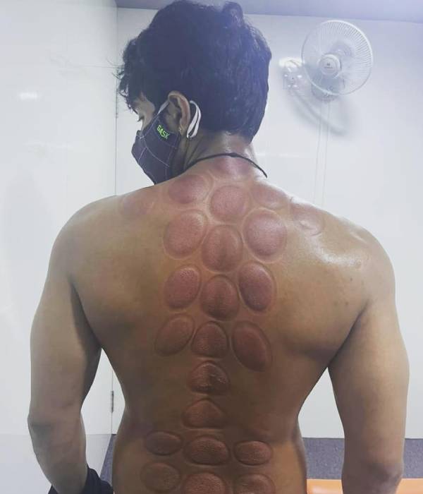 புதிய அற்புதமான தெரபி