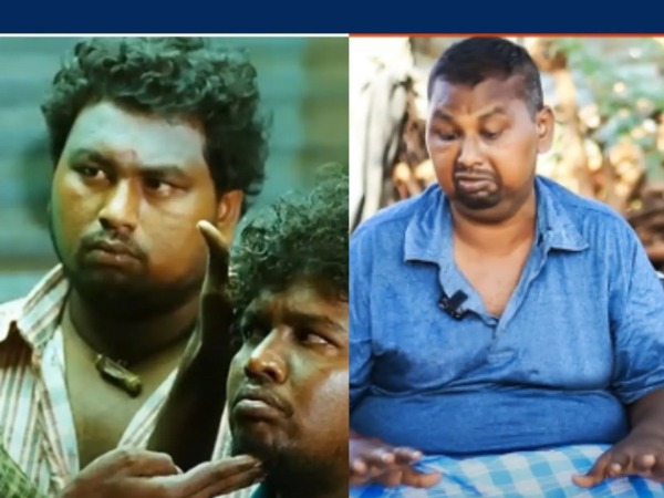 இரண்டு கிட்டினியும் செயலிழந்தது